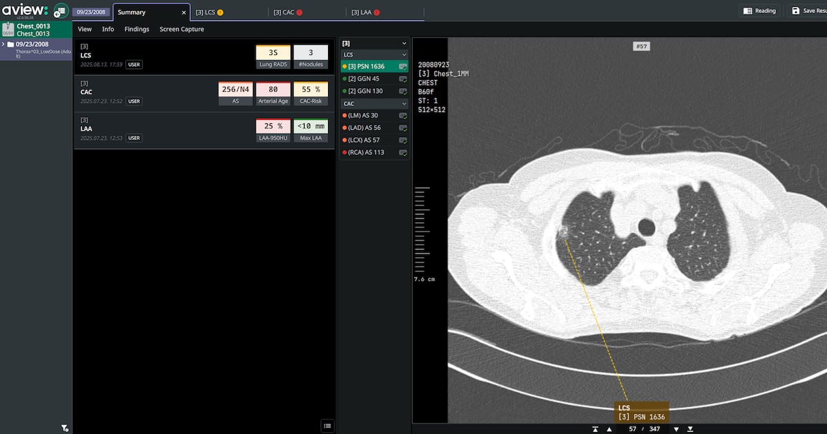 Korean AI Healthcare Developers Target Overseas Screening Networks